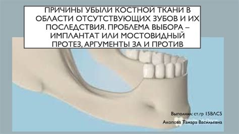 Повышенная прозрачность костной ткани: причины и последствия