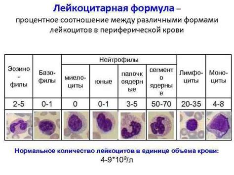 Повышенное количество эпителиальных мазков: что это?