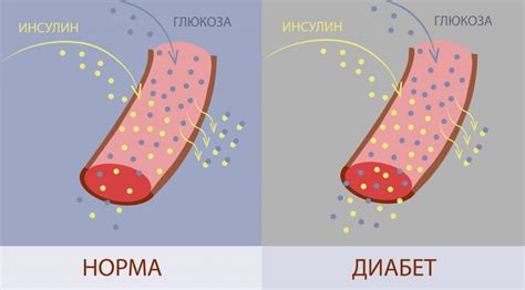 Повышенный инсулин: причины и последствия