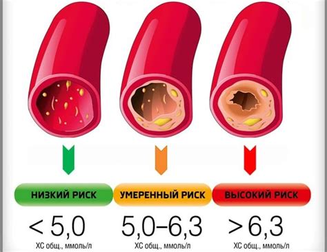 Повышенный холестерин