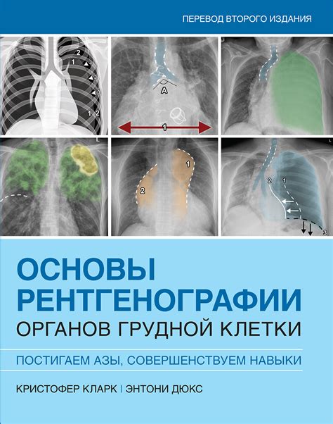 Подготовка и проведение обзорной рентгенографии органов грудной клетки