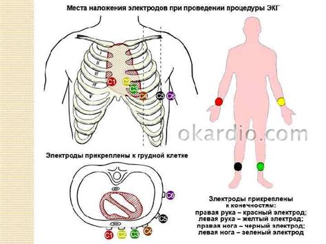 Подготовка к низковольтажной ЭКГ