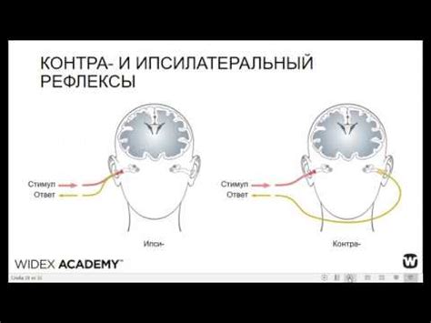 Показания для проведения тимпанометрии у ребенка: