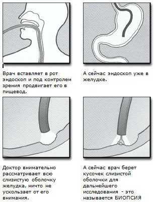 Показатели, указывающие на необходимость проведения ФГДС желудка в первой половине дня