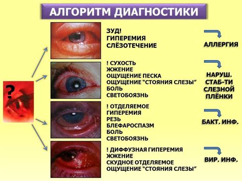 Покраснение глаз - сигнал о нарушении здоровья