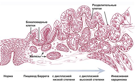 Покровно ямочный эпителий: причины и значение