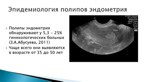 Полип эндометрия базального типа: общая информация