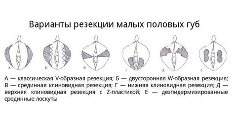 Половые губы: строение и функции