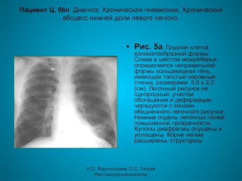 Положительные эффекты обогащения легочных полей на организм