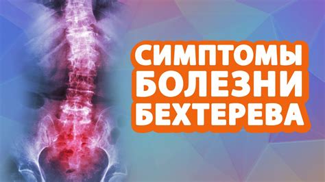 Положительный результат: причины и симптомы