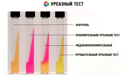 Положительный уреазный тест