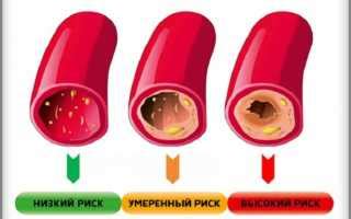 Польза снижения холестерина