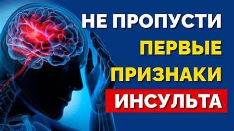 Помогающие символы: признаки предупреждения об инсульте в снах