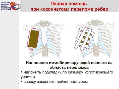 Помощь при обнаружении Мос грудины: к кому обратиться