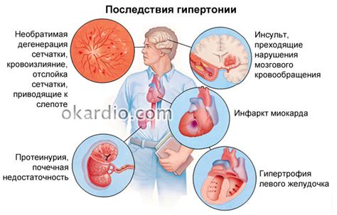 Понижение давления при гипертонии: симптомы и последствия