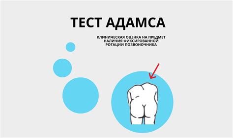 Понимание результатов теста Адамса