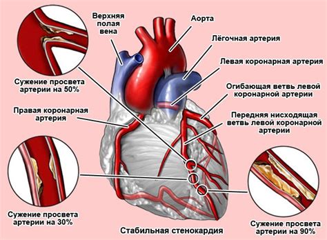 Понятие "колет справа"