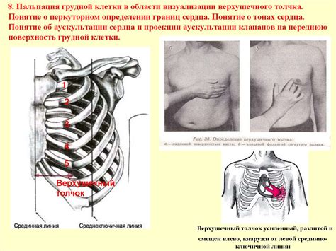 Понятие грудной жабы сердца