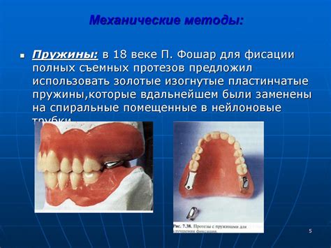 Понятие низкой фиксации ФДГ