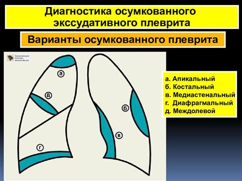 Понятие парамедиастинального