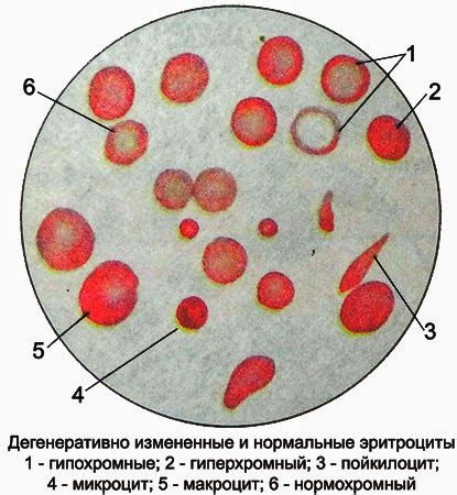 Понятие пойкилоцитоза