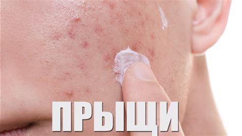 Популярные методы борьбы с ямками в коже