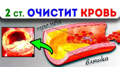 Популярные методы медицинского очищения крови