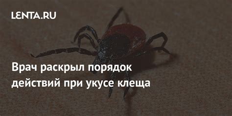 Порядок действий при укусе пауком