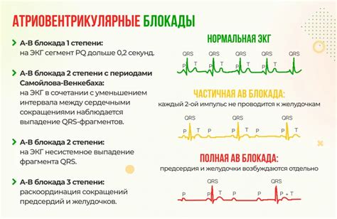 Последствия ЭКГ блокады