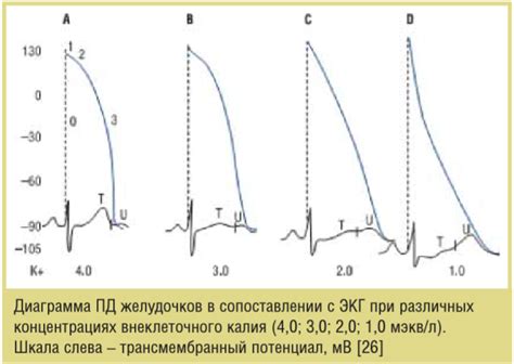 Последствия гипокалиемии