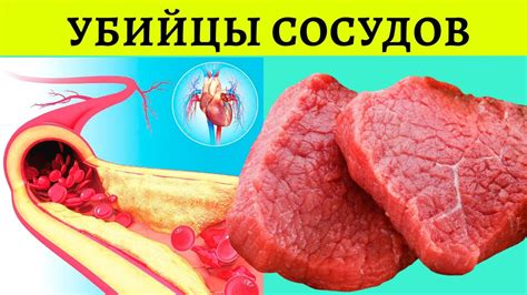 Последствия закупорки сосудов для здоровья человека