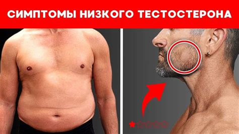 Последствия и риски низкого уровня тестостерона