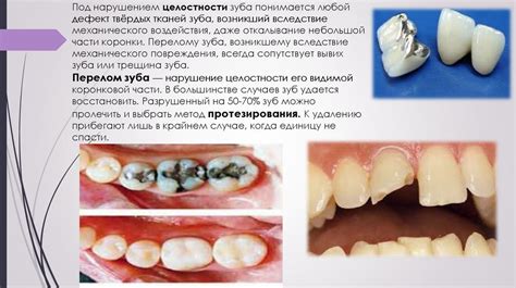 Последствия консолидации зубного ряда