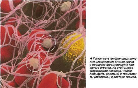 Последствия кровяного сгустка для организма