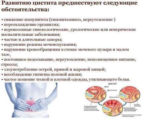 Последствия латентного течения цистита у женщин