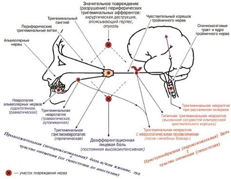 Последствия неактивности тригеминальных точек