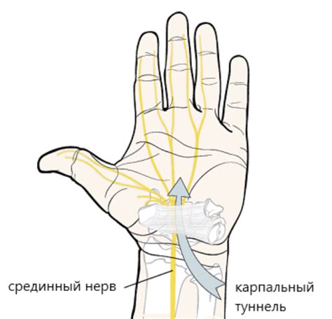 Последствия незапломбированного канала