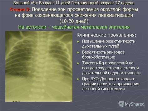 Последствия неоднородного снижения пневматизации