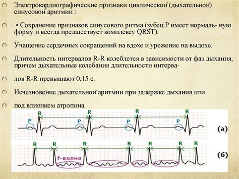 Последствия нерегулярного синусового ритма