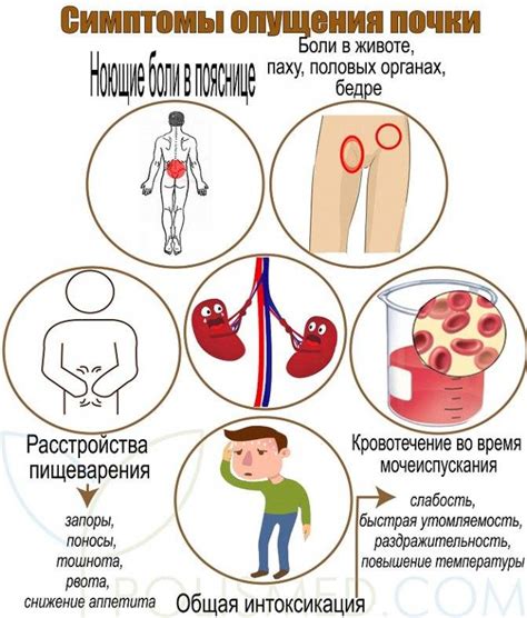 Последствия неровных контуров почки у женщин