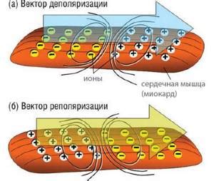 Последствия неспецифических изменений процессов реполяризации