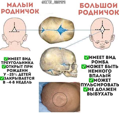 Последствия ношения слишком маленького размера