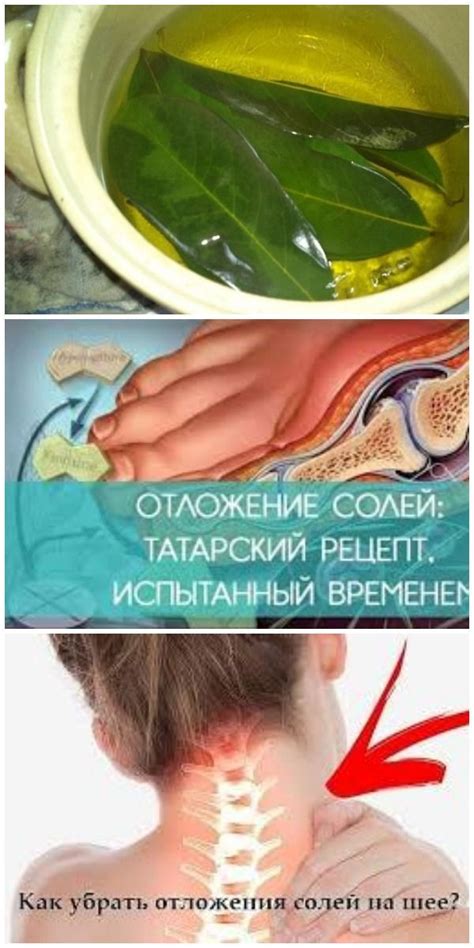 Последствия отложения солей для организма