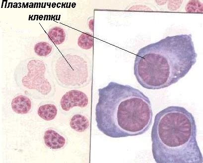 Последствия отсутствия плазматических клеток