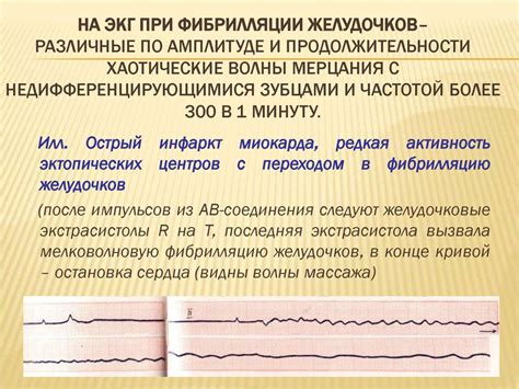 Последствия сердечного ритма 58 ударов