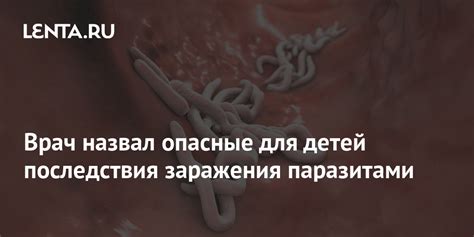 Последствия сна с паразитами: заболевания и риск заражения