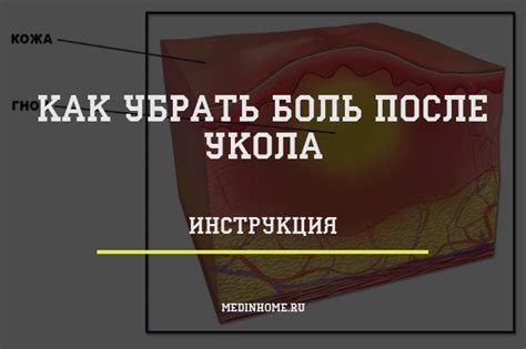 После внутримышечного укола