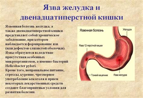 После приема мяса возникают боль в животе: причины и рекомендации