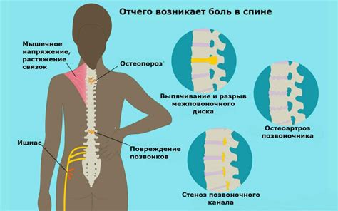 Постоянное надувание спины в районе лопатки: что делать