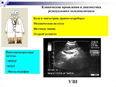 Постхолецистэктомический синдром